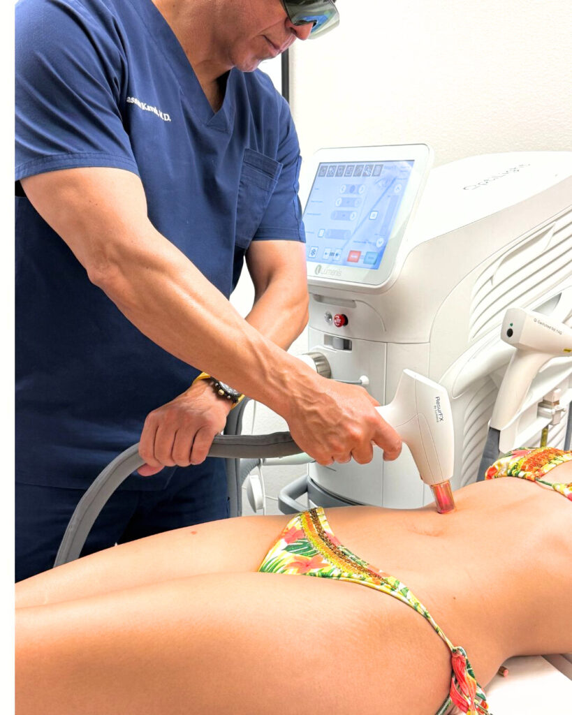Alpha_Medical_Aesthetics_Lumenis_ULTRAPulse_Alpha_Ablative_Scar_Removal_and_ResurFX_Non_Ablative_Scar_Removal_Summerlin Alpha_Medical_Aesthetics_Lumenis_ULTRAPulse_Alpha_Ablative_Scar_Removal_and_ResurFX_Non_Ablative_Scar_Removal_Summerlin