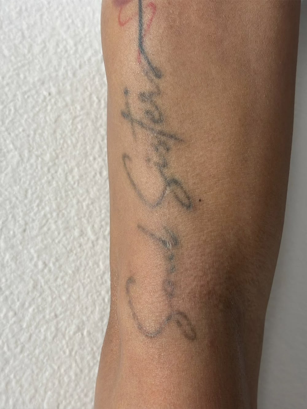 Alpha Medical Aesthetics Las Vegas Dr. Sassan Kaveh
