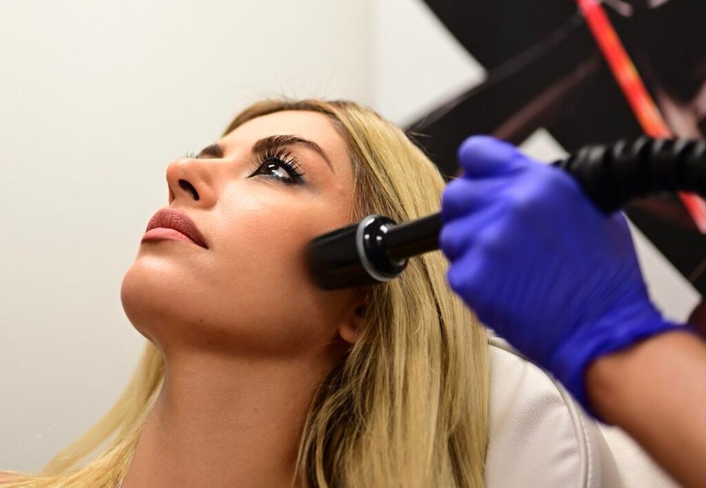 Alpha_Medical_Aesthetics_Lumenis_RF_Microneedling_TriFX_Skin_Tightening_Las_Vegas_Summerlin Alpha_Medical_Aesthetics_Lumenis_RF_Microneedling_TriFX_Skin_Tightening_Las_Vegas_Summerlin
