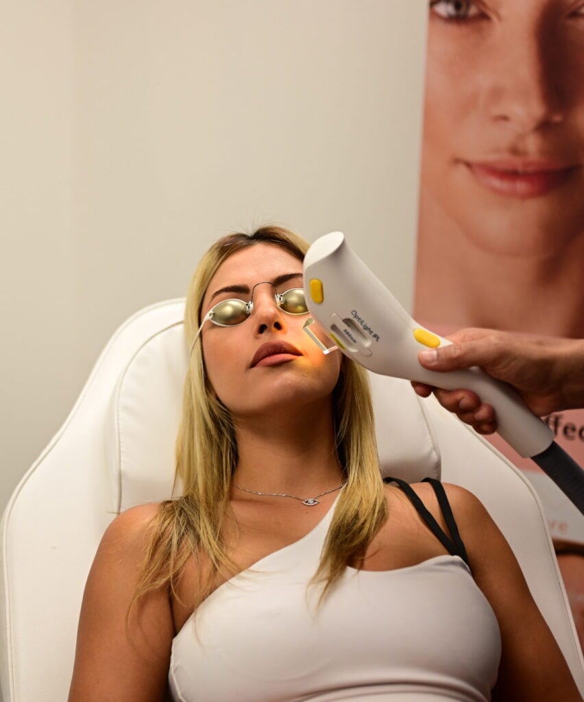 Alpha_Medical_Aesthetics_Lumenis_Stellar_M22_IPL_Hyper_Pigmentaion_Treatment_Las_Vegas_Summerlin Alpha_Medical_Aesthetics_Lumenis_Stellar_M22_IPL_Hyper_Pigmentaion_Treatment_Las_Vegas_Summerlin