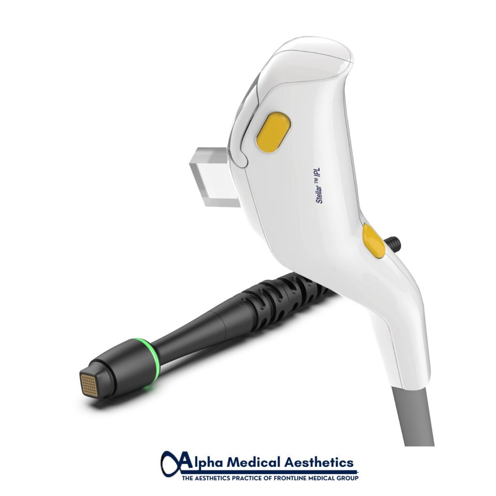 Alpha_Medical_Aesthetics_Lumenis_SmoothGLO_IPL_And_RF_Microneedling_Las_Vegas_Dr._Sassan_Kaveh_Centennials_Hills Alpha_Medical_Aesthetics_Lumenis_SmoothGLO_IPL_And_RF_Microneedling_Las_Vegas_Dr._Sassan_Kaveh_Centennials_Hills