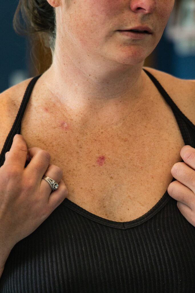 Alpha_Medical_Aesthetics_Lumenis_SmoothGLO_For_Face_And_Body_Skin_Discoloration_And Pigmentaion_And_Laxity_Las_Vegas Alpha_Medical_Aesthetics_Lumenis_SmoothGLO_For_Face_And_Body_Skin_Discoloration_And Pigmentaion_And_Laxity_Las_Vegas