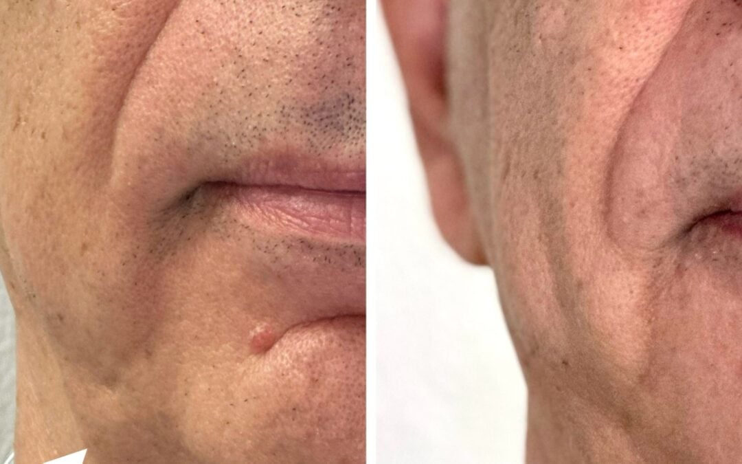 Non-Surgical Facelift Options in Las Vegas: A Doctor’s Comparison Guide