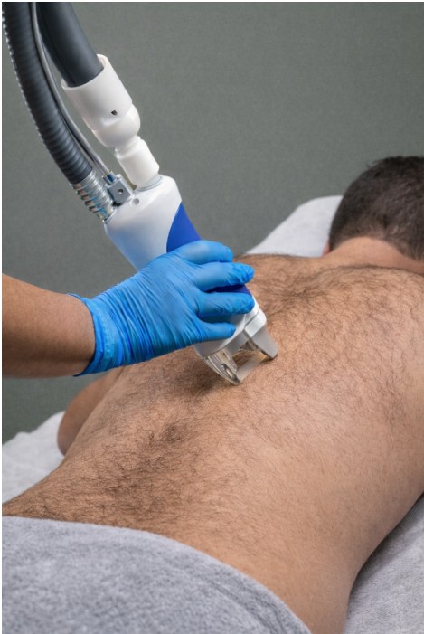 Alpha_Medical_Aesthetics_Lumenis_SplendorX_Laser_Hair_Removal_How_Many_Laser_Hair_Removal_Sessions_at_Dr._Sassan_Kaveh_Desert_Shores_Las_Vegas Alpha_Medical_Aesthetics_Lumenis_SplendorX_Laser_Hair_Removal_How_Many_Laser_Hair_Removal_Sessions_at_Dr._Sassan_Kaveh_Desert_Shores_Las_Vegas