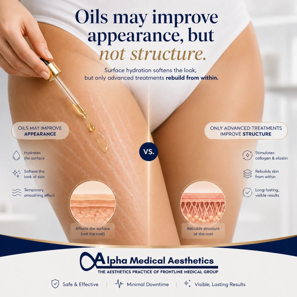 Alpha_Medical_Aesthetics_Stretch_Mark_Removal_Oil_May_Improve_Appearance_Not_Structure Alpha_Medical_Aesthetics_Stretch_Mark_Removal_Oil_May_Improve_Appearance_Not_Structure