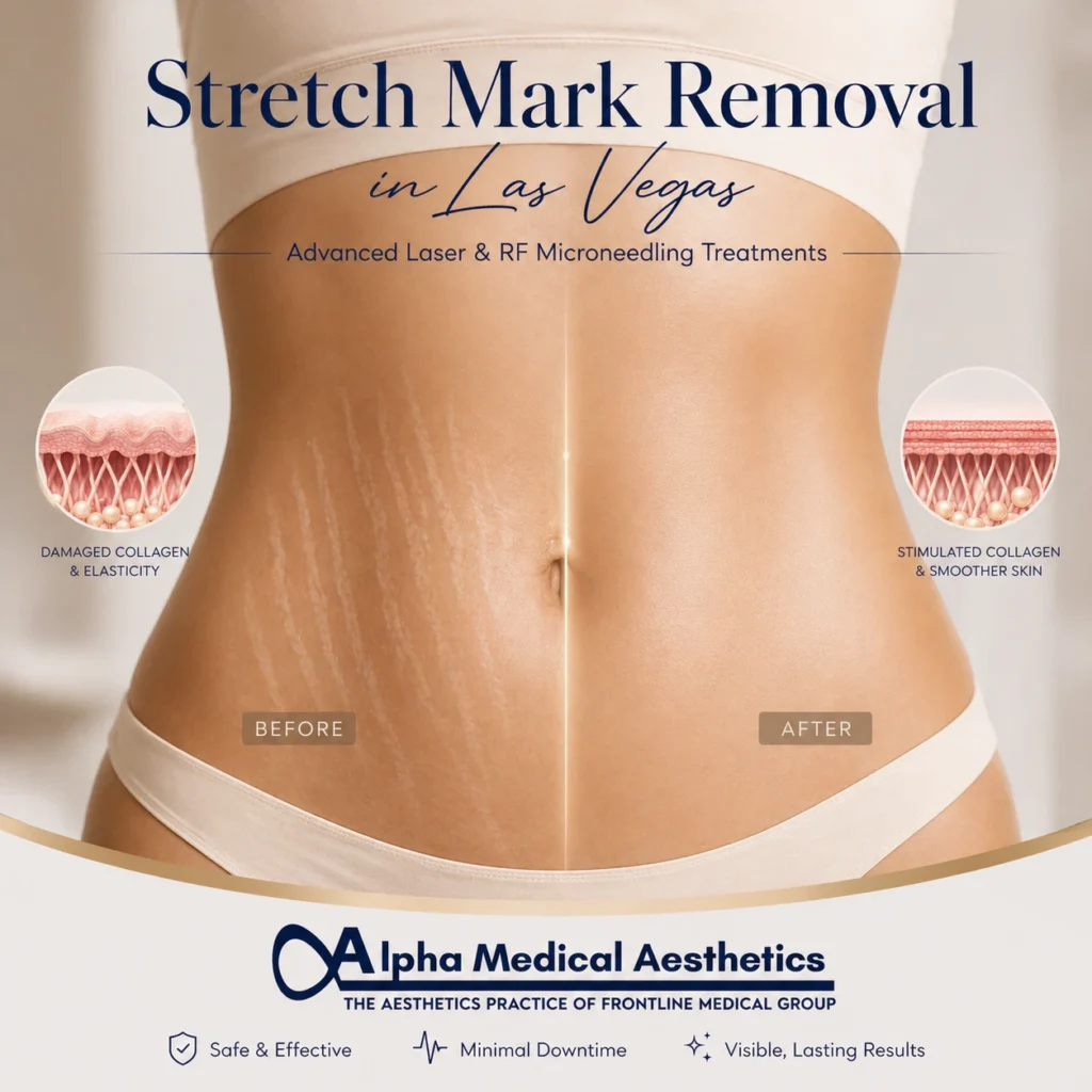 Alpha_Medical_Aesthetics_Stretch_Mark_Removal_in_Las_Vegas Alpha_Medical_Aesthetics_Stretch_Mark_Removal_in_Las_Vegas