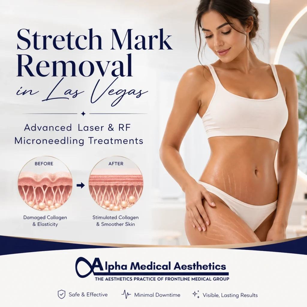 Alpha_Medical_Aesthetics_Stretch_Mark_Removal_in_Las_Vegas_Dr._Sassan_Kaveh Alpha_Medical_Aesthetics_Stretch_Mark_Removal_in_Las_Vegas_Dr._Sassan_Kaveh