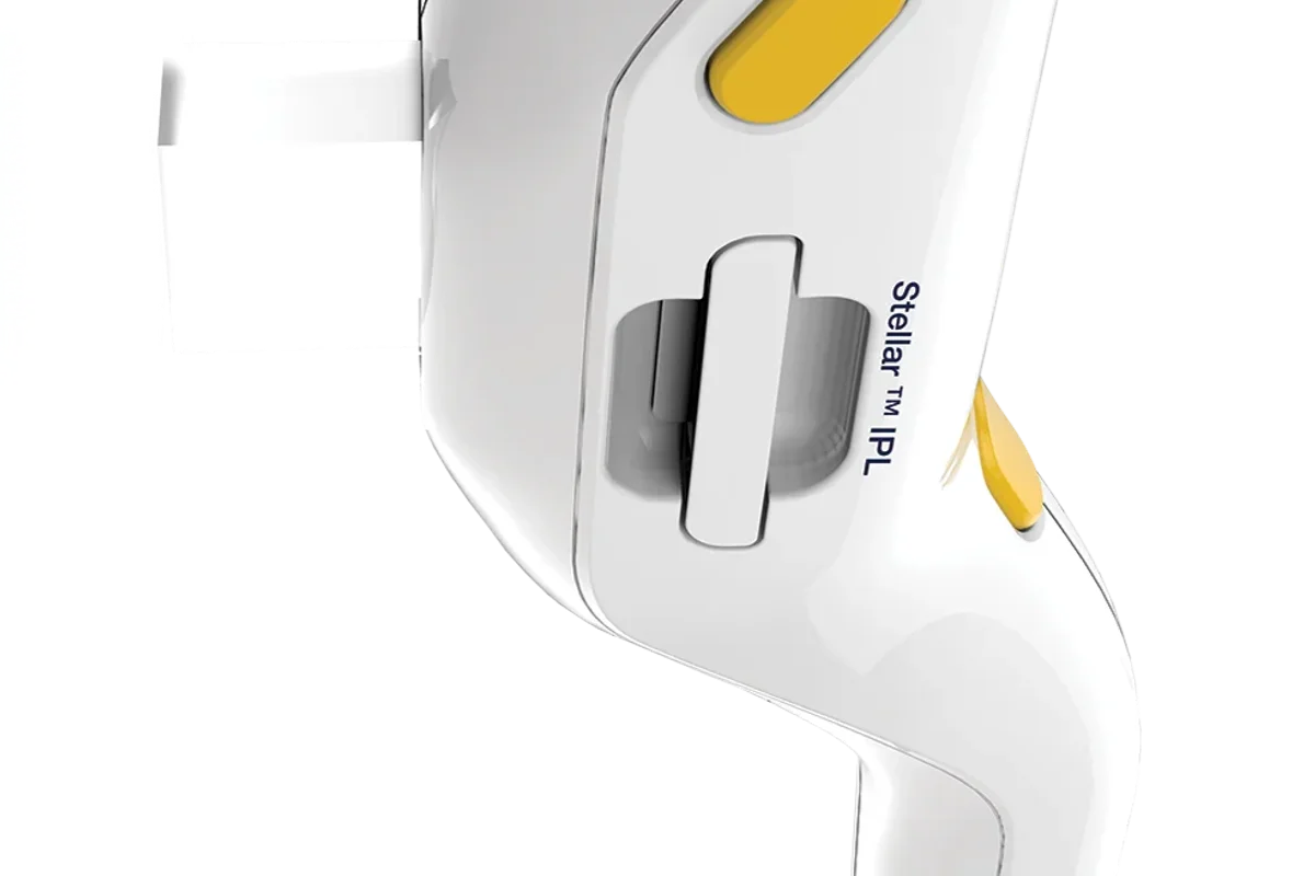 IPL for hyperpigmentation in Las Vegas