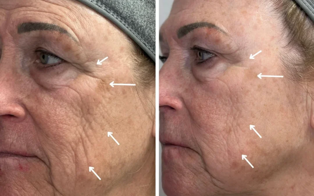 TriGlo: My Go-To Combination for Total Skin Rejuvenation