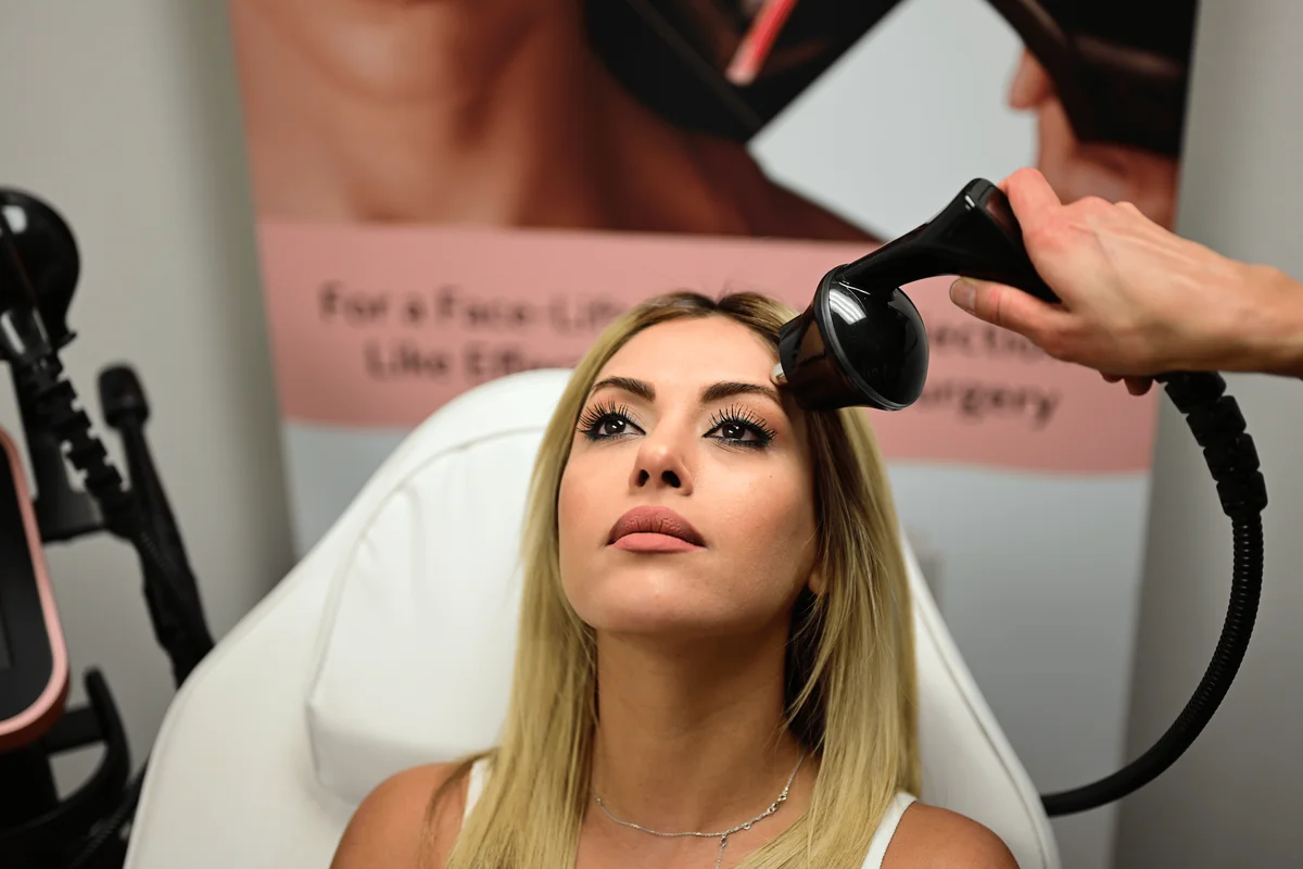 Radiofrequency skin tightening as a non-surgical facelift option