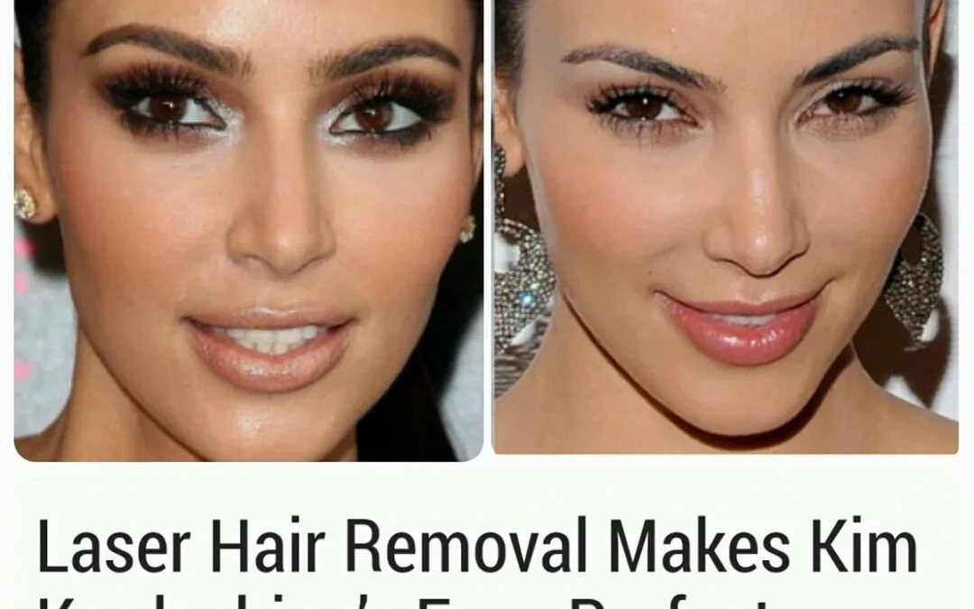 Where Do the Kardashians Go for Laser Hair Removal?