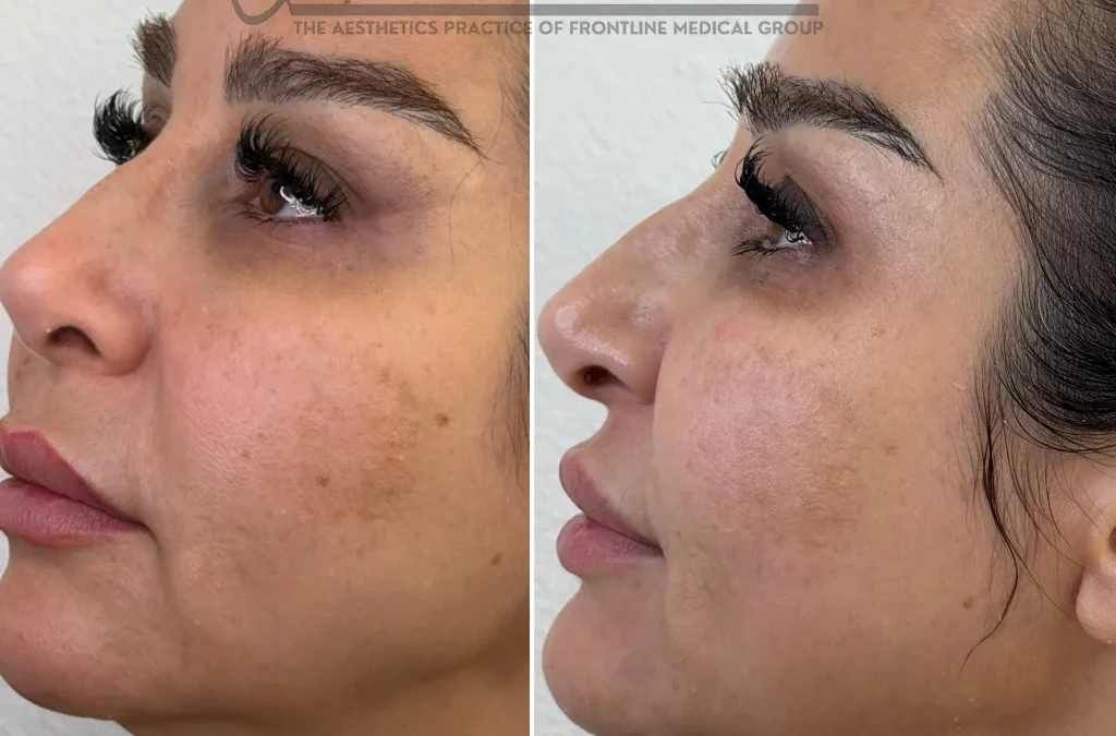 The Complete Guide to Non-Invasive Facial Rejuvenation in Las Vegas